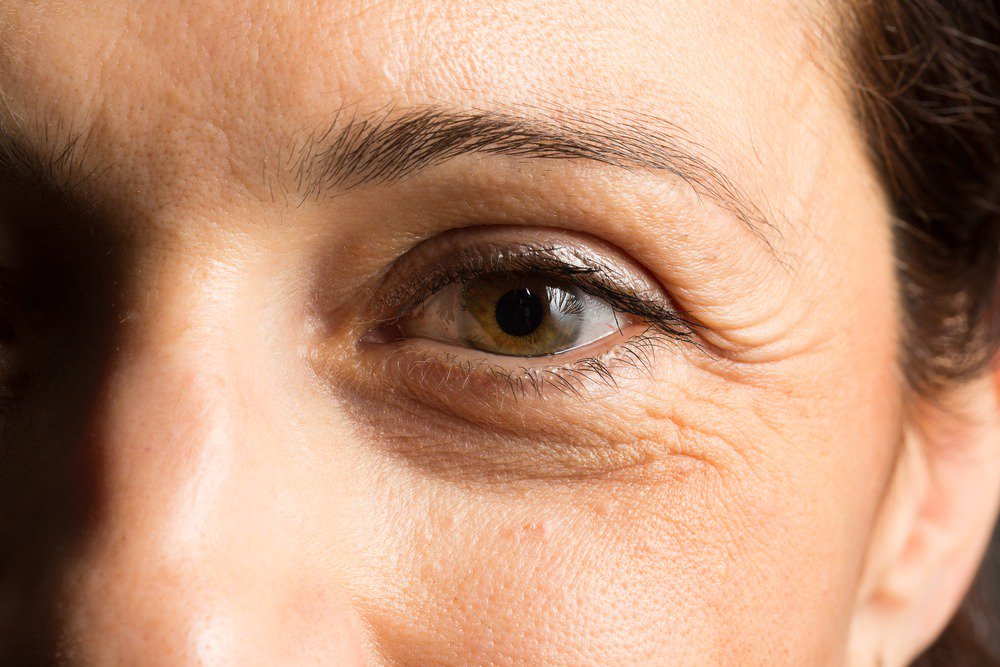 Dry skin under the eyes