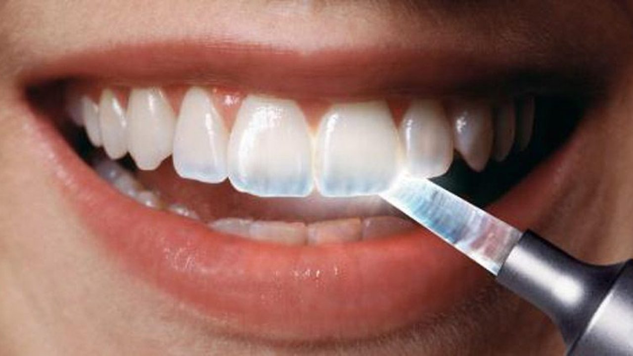 Picture of Teeth Without Enamel