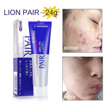  Lion Pair Acne Cream